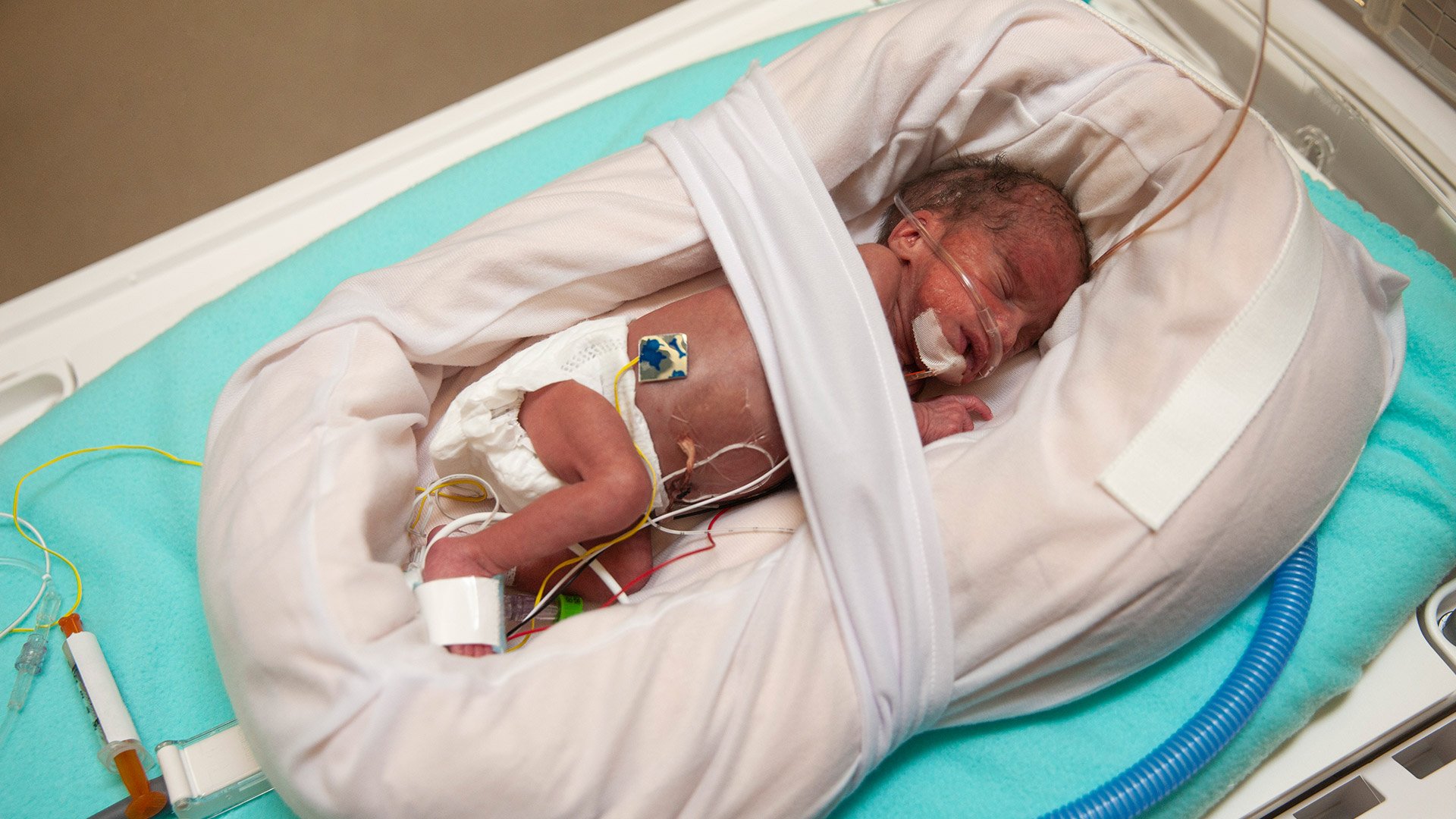 Mölnlycke Z-Flo Fluidized Positioner for Neonatal intensive care device