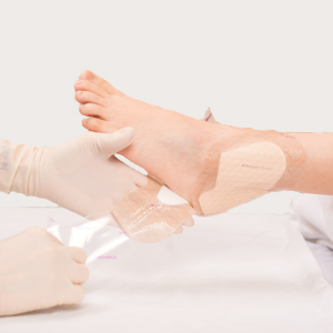 border mepilex heel dressing apply area wound prevention flaps application step molnlycke stretch tabs backing repeat smooth remove
