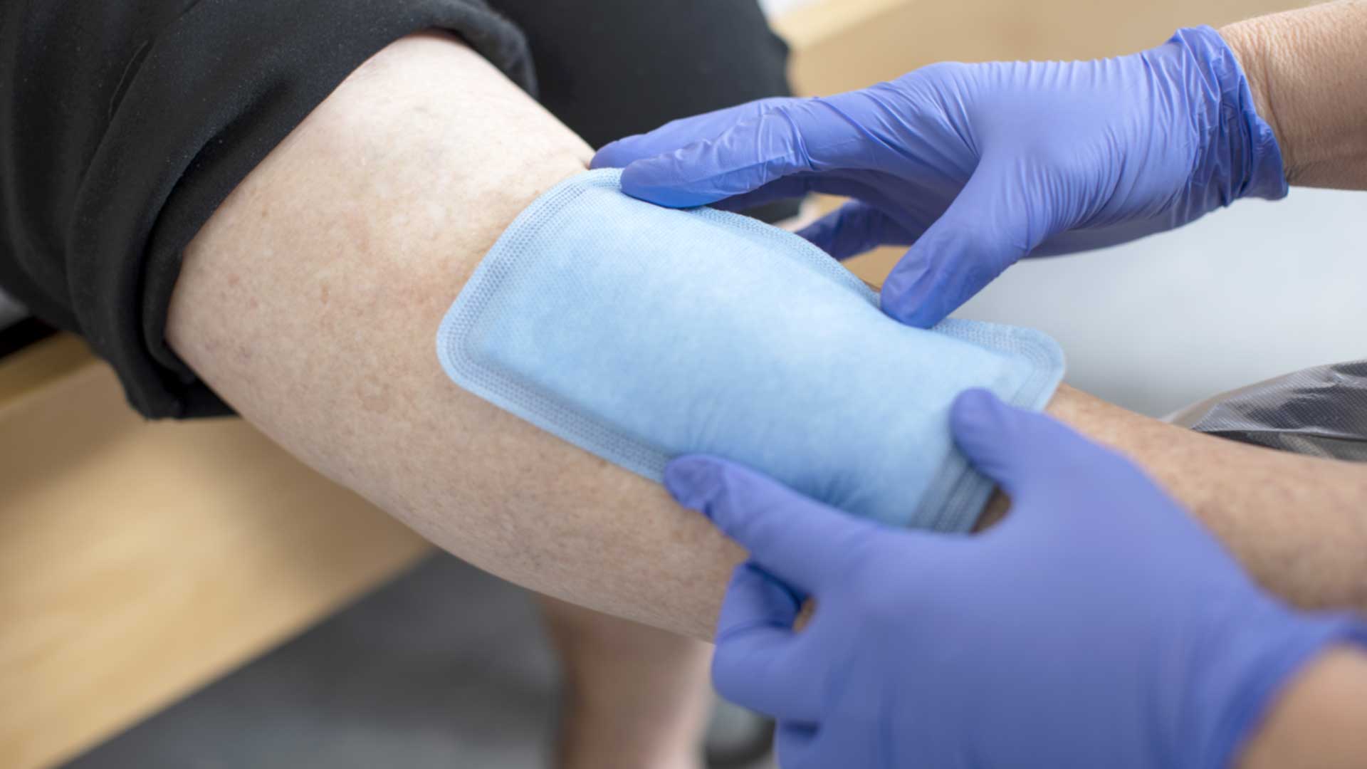 Mextra Superabsorbent wound dressing for highly exuding wounds Mölnlycke