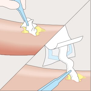 mesalt-howto-2