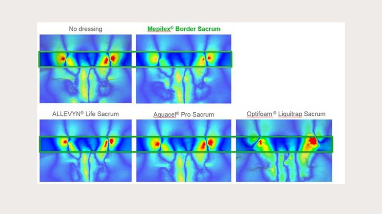 finite element modeling of Mepilex Border Sacrum vs competitors